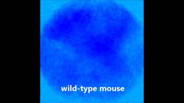 Serotonin Alleviates Autism Symptoms in Mice (7 of 7)