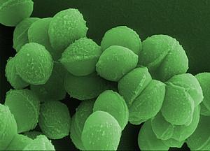 <i>Streptococcus pyogenes</i>