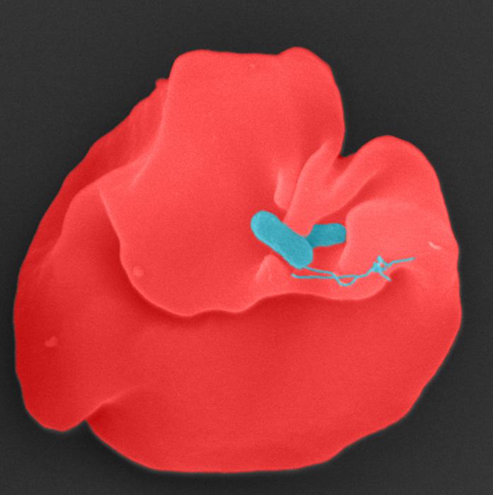 Bartonella bacilliformis