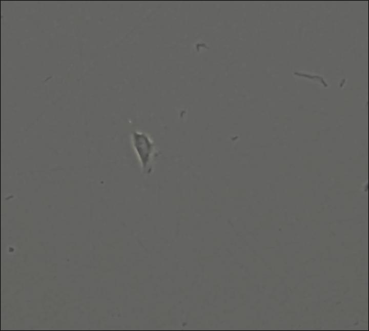 Human Skeletal Stem Cell