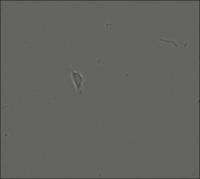 Human Skeletal Stem Cell