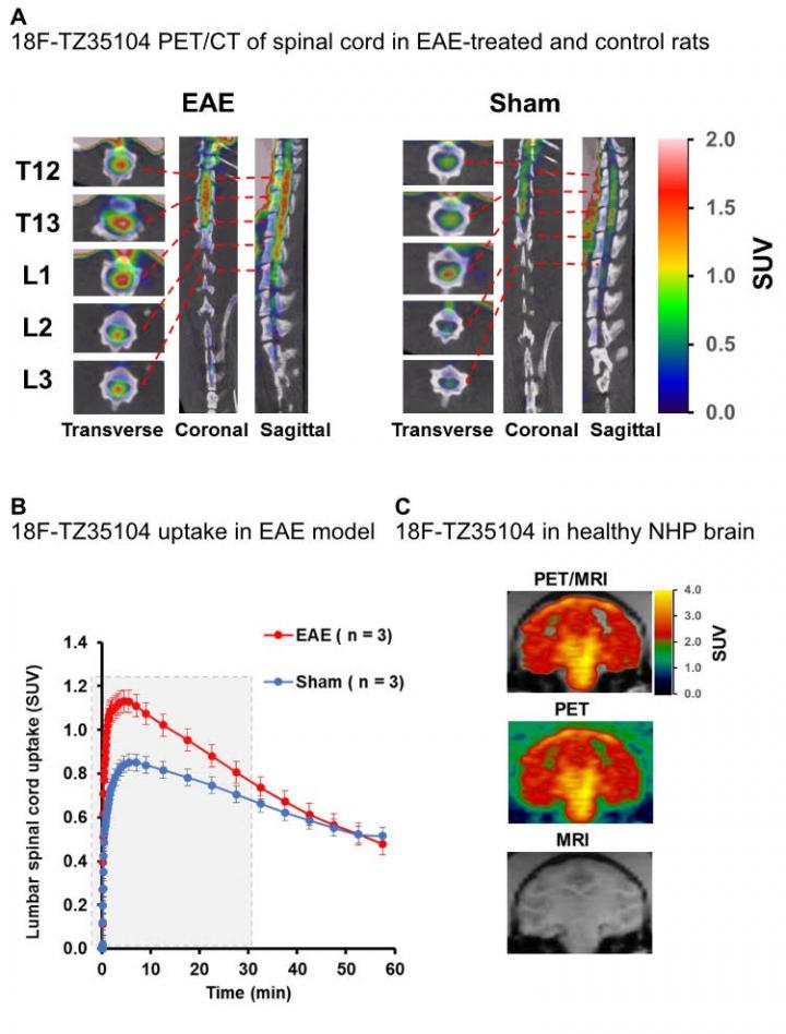 PET Tracers for Imaging MS