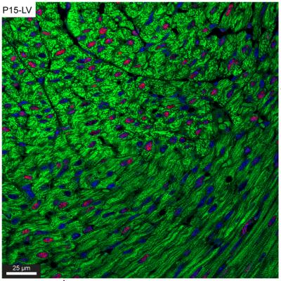Cardiac Muscle at Day 15