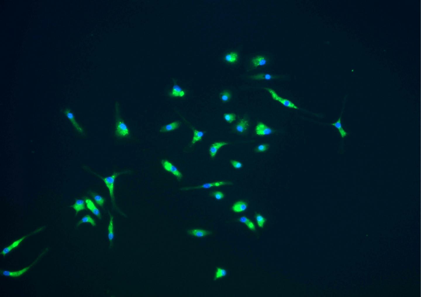 Microglia, Part of the Immune Response that Protect the Brain