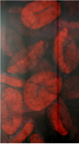 Illustration of Infected Red Blood Cells