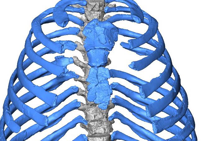 Thorax of Kebara 2