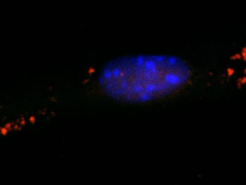 Healthy Control Nerve Cells