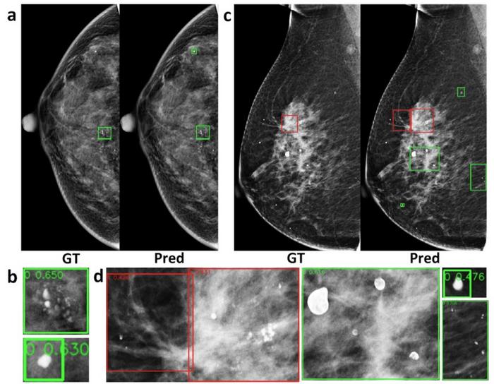Figure 1: Results of microcalcification detection experiments.