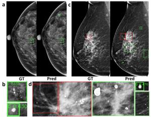 Figure 1: Results of microcalcification detection experiments.