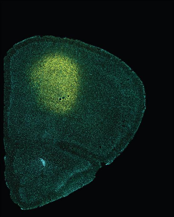 Identificados nuevos circuitos neuronales que están alterados en la enfermedad de Huntington