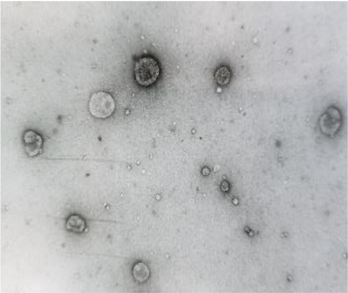 Urine extracellular vesicles (uEVs)