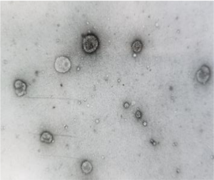 Urine extracellular vesicles (uEVs)