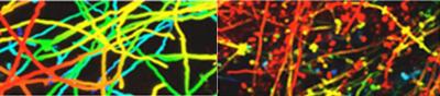 <i>Candida albicans</i> Biofilm