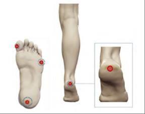 Proderma