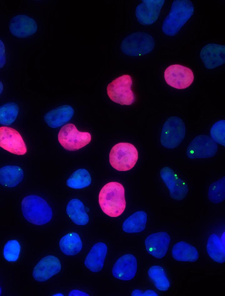 DNA Damage