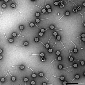 Telomere phages from Klebsiella, viewed by transmission electron microscopy.
