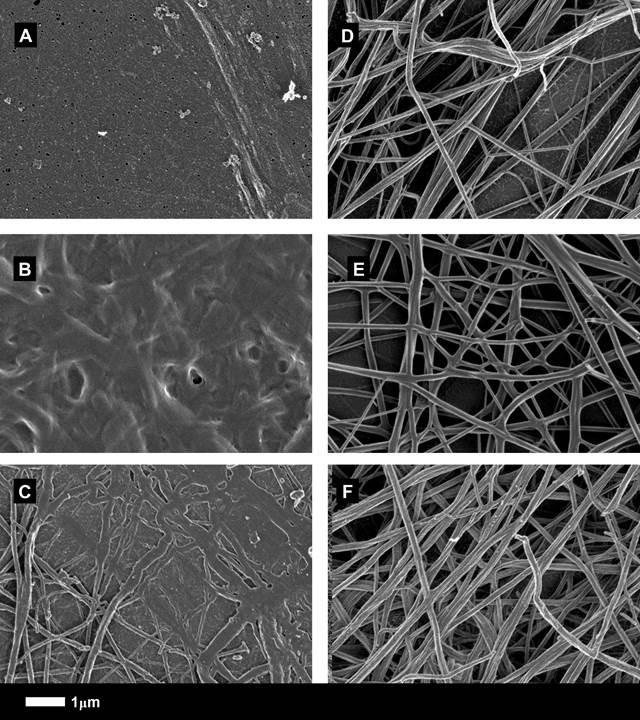 Micrographs of Type 2 Diabetes Clots Before and After Treatment