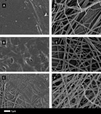 Micrographs of Type 2 Diabetes Clots Before and After Treatment