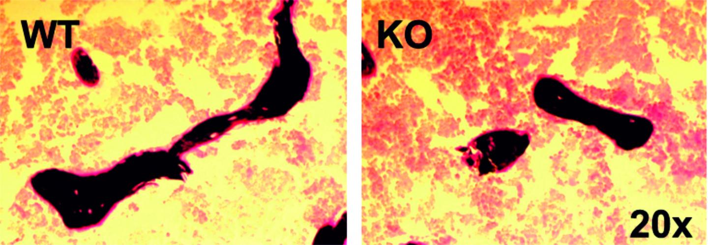 Bringing Balance to Fat and Bone Stem Cells (1 of 1)