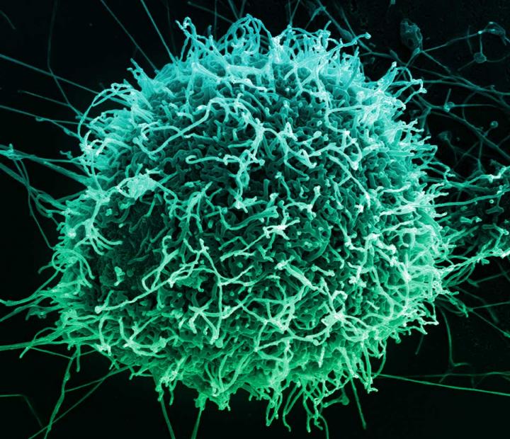 Ebola Virus