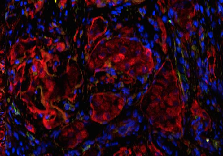 Islets in the Omentum Transplanted within the Biologic Scaffold