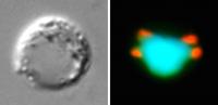 Condensin