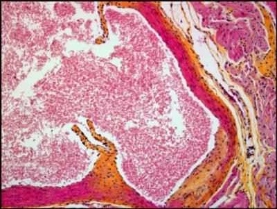 Mouse Immunized with AT04A