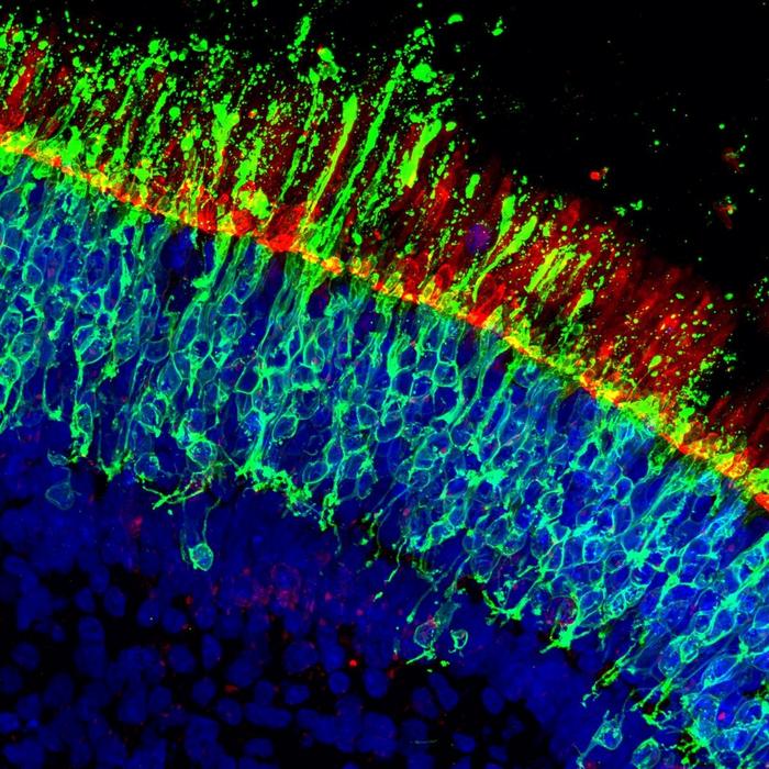 Human Retinal Organoid