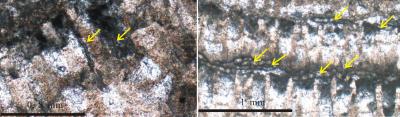 Invading Bacteria-Algae