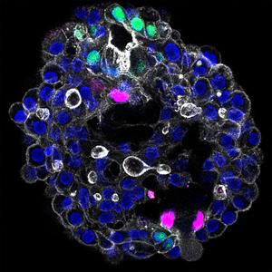 Human periportal assembloid