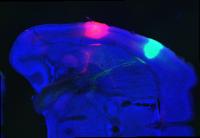 'Taste Cells' in the Brain