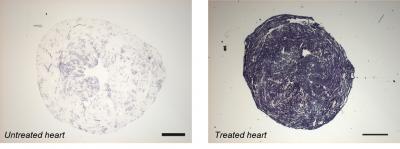Untreated Heart/Treated Heart