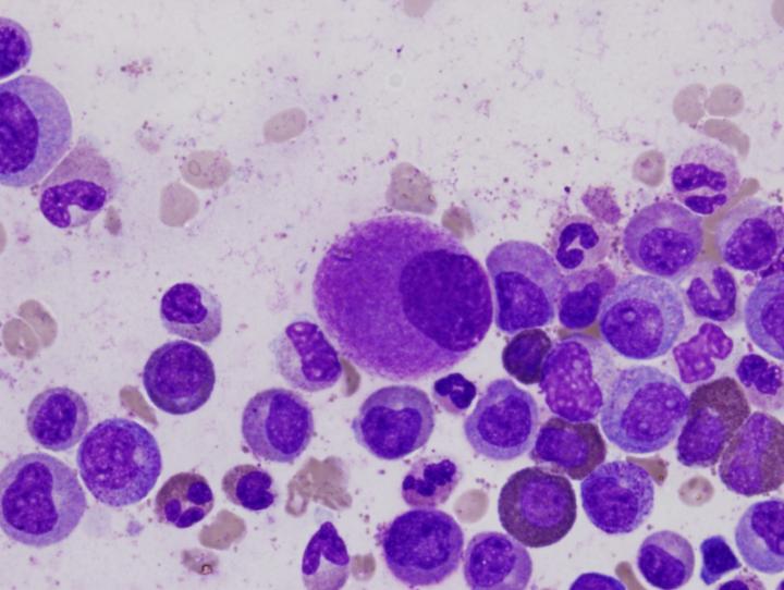 CML Cells