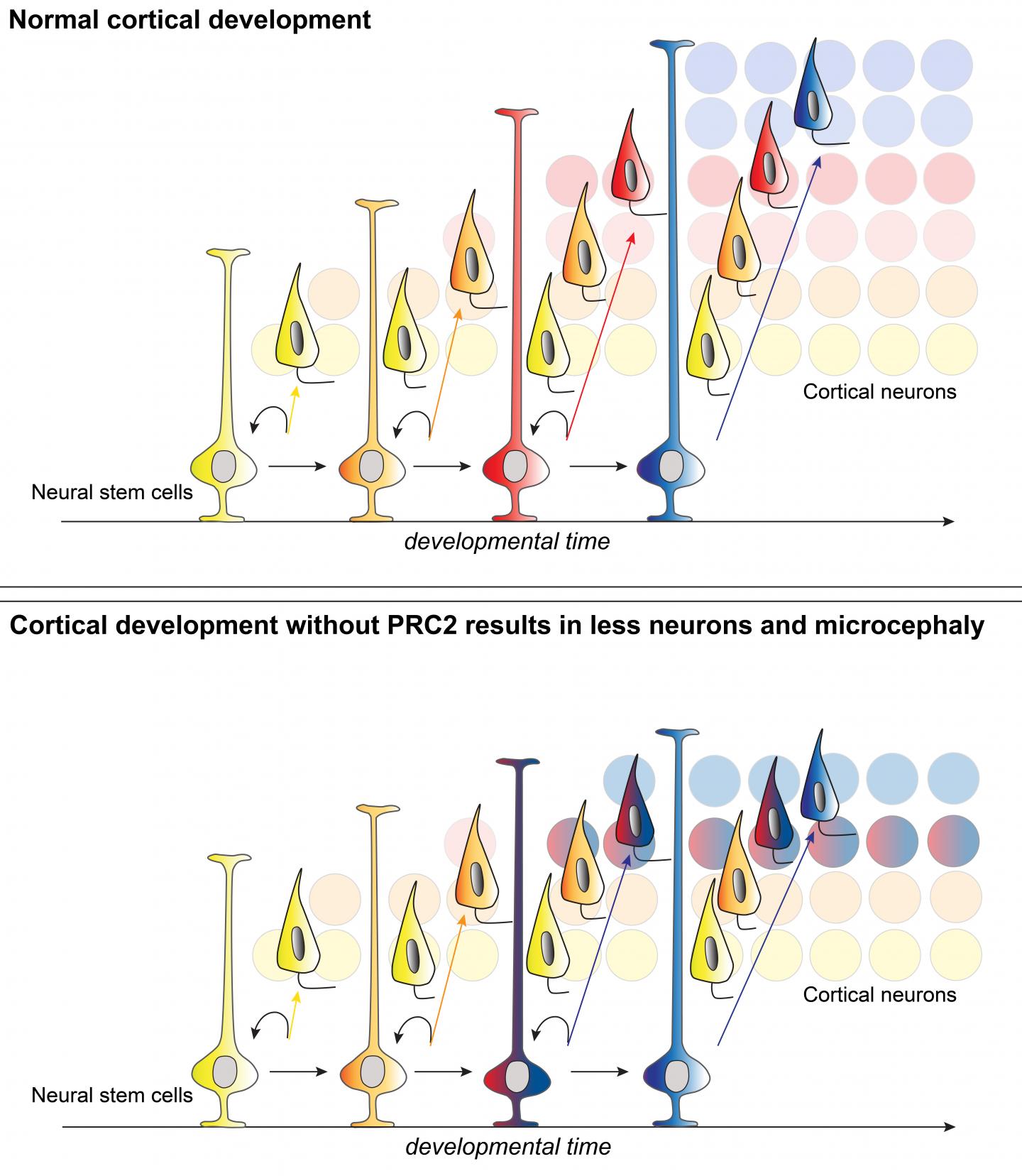 Normal Cortical Development Vs. Irregular Cortical Development
