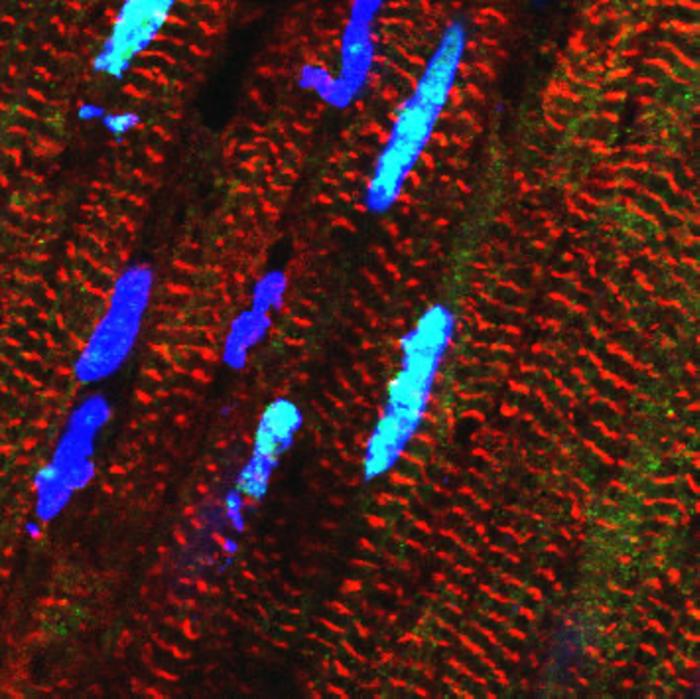 RBM20 proteins