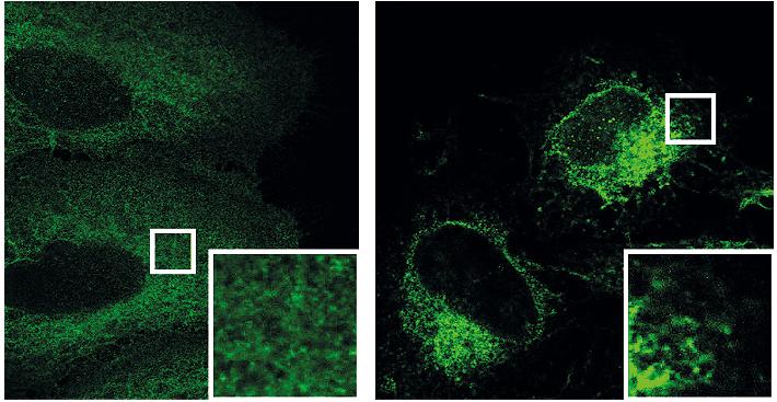 Protein Kinase N (PKN)