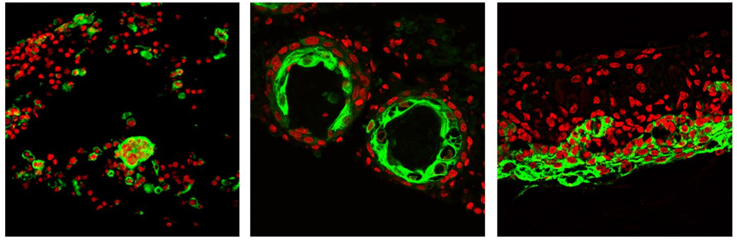 Skin Organoids