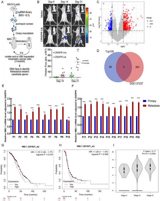 The NBL1 gene plays a crucial role in the metastasis of OC and is associated with a poor prognosis for patients.