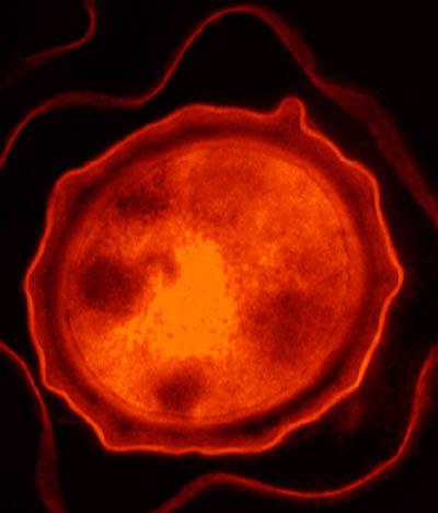 Anthrax Microbe