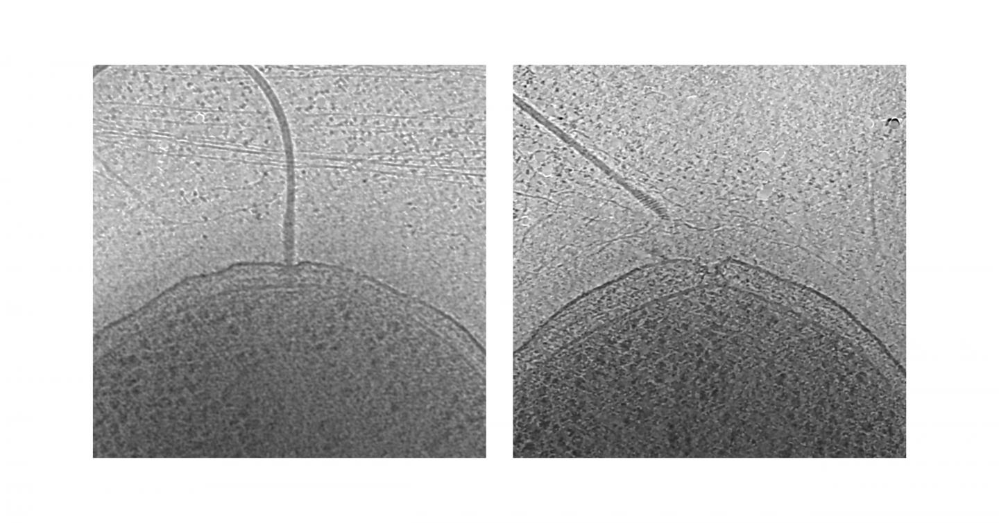 Drastic Measure of Ejecting their Flagella Could Help Microbes Save Energy during Nutrient Depletion
