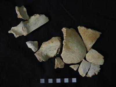 Skulls with Mix of Traits Illuminate Human Evolution (4 of 18)