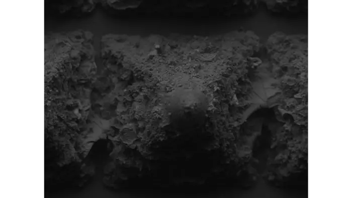 Dissolvable, microscopic needles light the way for cancer treatments