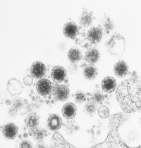 Electron Micrograph, HHV-6, University of California San Diego