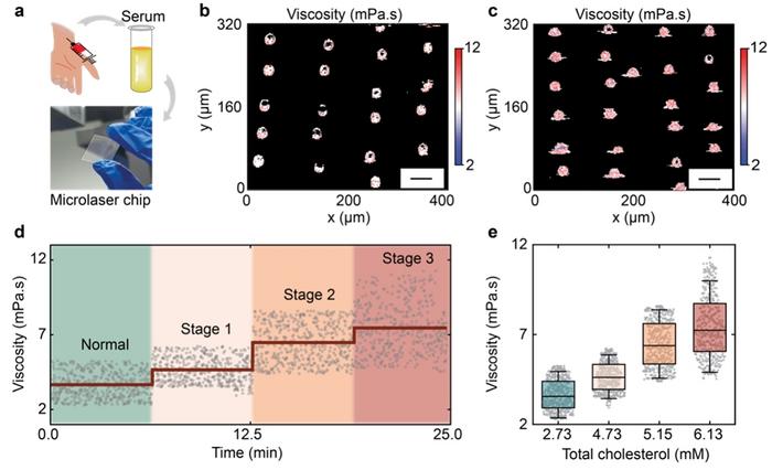 Figure 3 | High-throughput screening of hyperlipidemia.