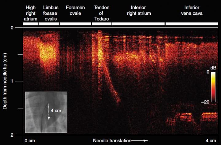 Two-Dimensional All-Optical Ultrasound Imaging