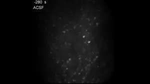 Time-lapse fluorescence images of a living mouse brain during the clearing process.