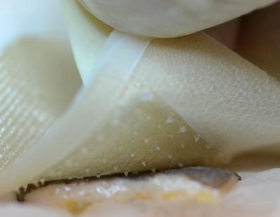 Chitin Microneedle Patch