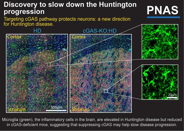 Huntington Disease Key Immune Pathway