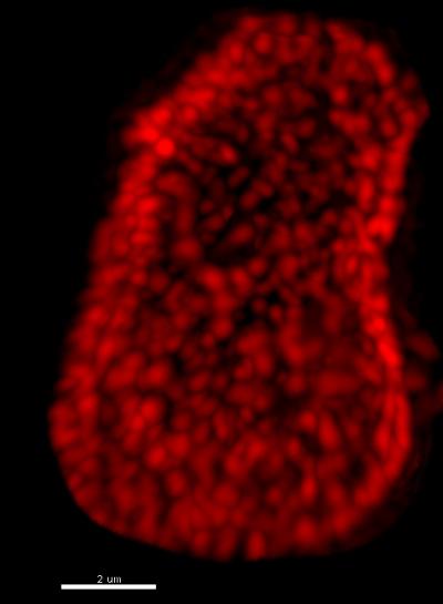 The 'Weakest Link' in the Aging Proteome