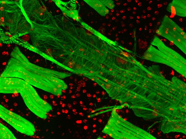 Fruit Fly Cardiac Muscle under Magnification